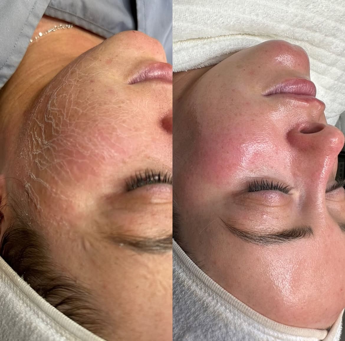 Million Dollar Miracle Mask — Before and After