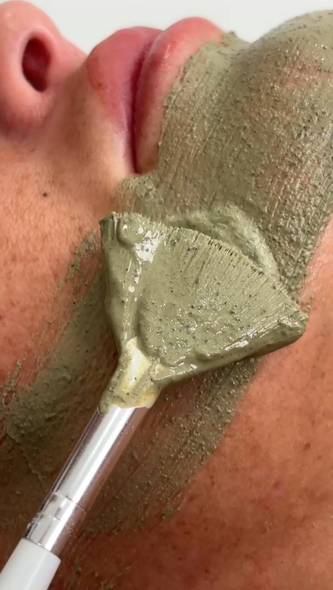 Million Dollar Superfacials