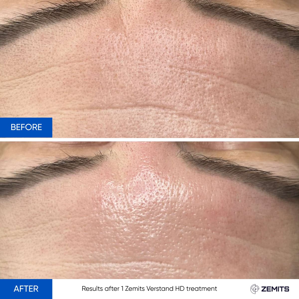 Signature Skin Treatment Results