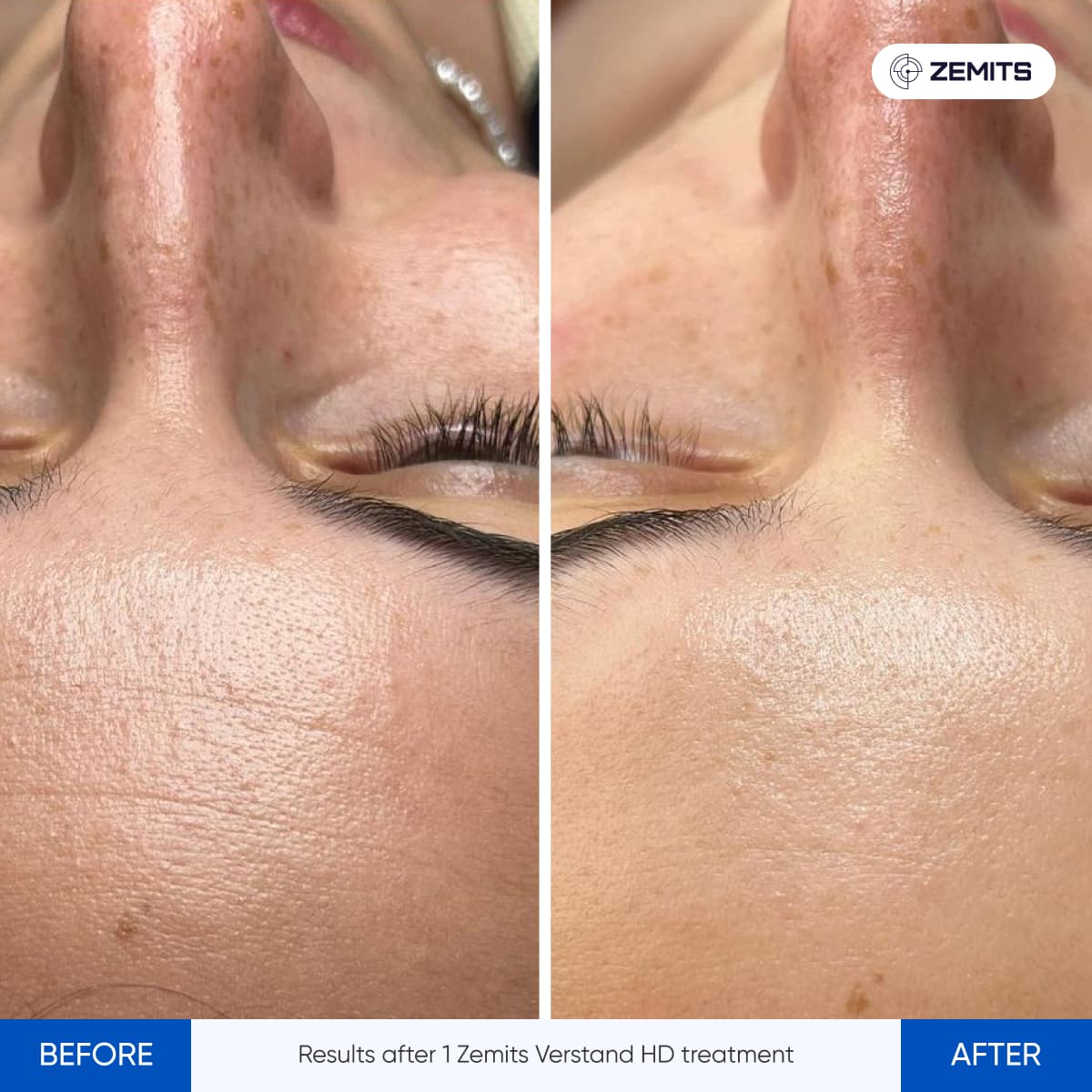 Signature Skin Treatment Results