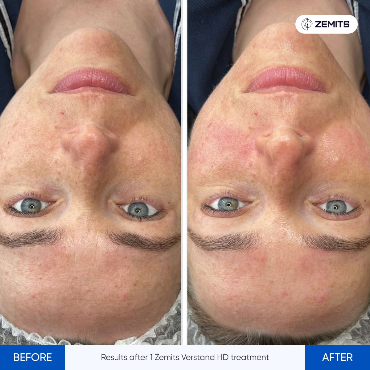 Signature Skin Treatment Results