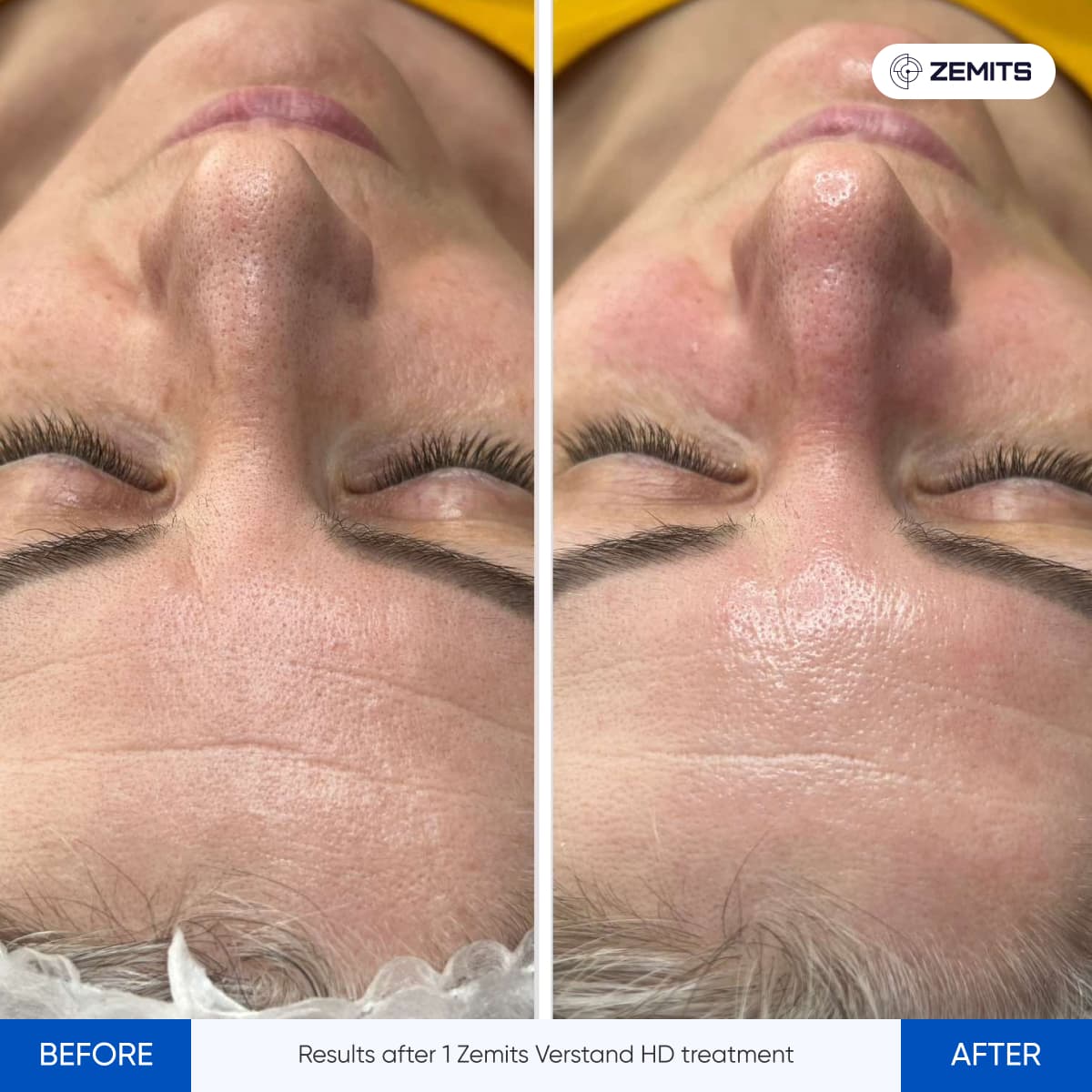 Signature Skin Treatment Results